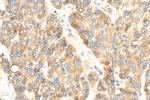 C4 Gamma Chain Antibody in Immunohistochemistry (Paraffin) (IHC (P))