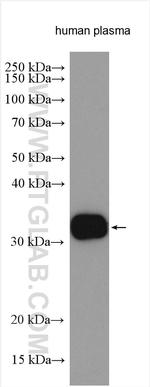 C4 Gamma Chain Antibody in Western Blot (WB)