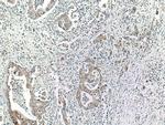 ADH1B Antibody in Immunohistochemistry (Paraffin) (IHC (P))