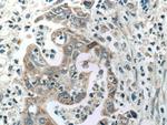 ADH1B Antibody in Immunohistochemistry (Paraffin) (IHC (P))