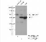 ADH1B Antibody in Immunoprecipitation (IP)