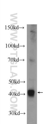 ADH1B Antibody in Western Blot (WB)