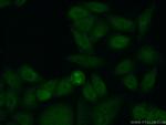 APOBEC4 Antibody in Immunocytochemistry (ICC/IF)