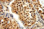 APOBEC4 Antibody in Immunohistochemistry (Paraffin) (IHC (P))