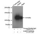 IARS2 Antibody in Immunoprecipitation (IP)