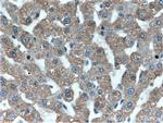MT1X Antibody in Immunohistochemistry (Paraffin) (IHC (P))