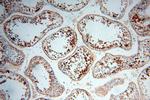 DNAJB3 Antibody in Immunohistochemistry (Paraffin) (IHC (P))