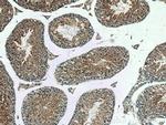 DNAJB3 Antibody in Immunohistochemistry (Paraffin) (IHC (P))