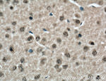 CDK10 Antibody in Immunohistochemistry (Paraffin) (IHC (P))