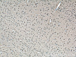 CDK10 Antibody in Immunohistochemistry (Paraffin) (IHC (P))