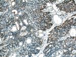 AFAP1L2 Antibody in Immunohistochemistry (Paraffin) (IHC (P))