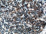 AFAP1L2 Antibody in Immunohistochemistry (Paraffin) (IHC (P))