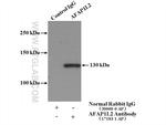 AFAP1L2 Antibody in Immunoprecipitation (IP)