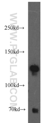 AFAP1L2 Antibody in Western Blot (WB)