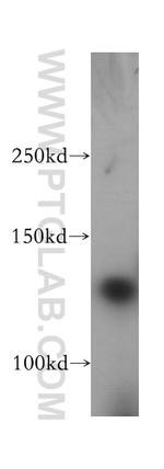 AFAP1L2 Antibody in Western Blot (WB)