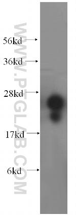 METTL11A Antibody in Western Blot (WB)