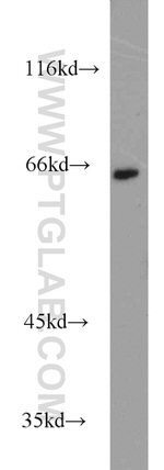 CBFA2T3 Antibody in Western Blot (WB)