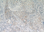 RSPO3 Antibody in Immunohistochemistry (Paraffin) (IHC (P))