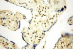 MGMT Antibody in Immunohistochemistry (Paraffin) (IHC (P))