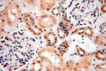 MGMT Antibody in Immunohistochemistry (Paraffin) (IHC (P))