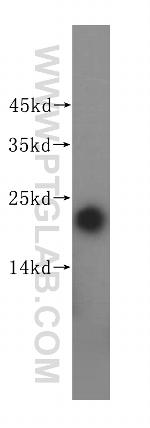 MGMT Antibody in Western Blot (WB)