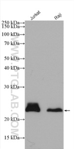 MGMT Antibody in Western Blot (WB)