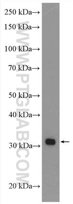 HMGCLL1 Antibody in Western Blot (WB)
