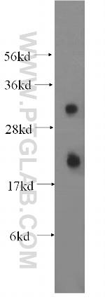 CEACAM21 Antibody in Western Blot (WB)