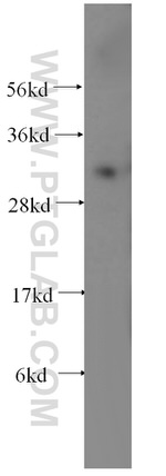 CEACAM21 Antibody in Western Blot (WB)