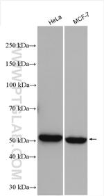 NPEPL1 Antibody in Western Blot (WB)