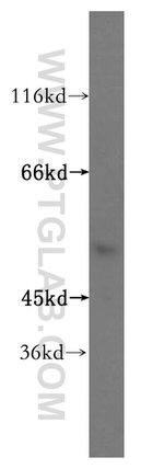 NPEPL1 Antibody in Western Blot (WB)