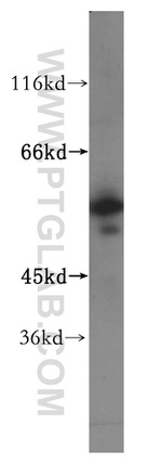 NPEPL1 Antibody in Western Blot (WB)