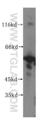 NPEPL1 Antibody in Western Blot (WB)