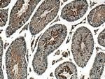 GPD2 Antibody in Immunohistochemistry (Paraffin) (IHC (P))