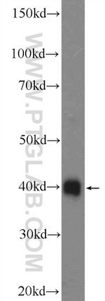 RBM11 Antibody in Western Blot (WB)