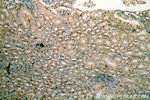 HLA-DRA Antibody in Immunohistochemistry (Paraffin) (IHC (P))