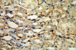 HLA-DRA Antibody in Immunohistochemistry (Paraffin) (IHC (P))