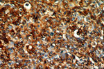 HLA-DRA Antibody in Immunohistochemistry (Paraffin) (IHC (P))