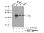 HLA-DRA Antibody in Immunoprecipitation (IP)
