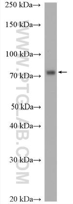RIOK1 Antibody in Western Blot (WB)