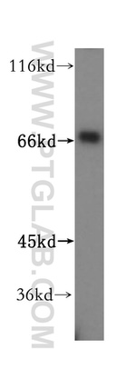 RIOK1 Antibody in Western Blot (WB)