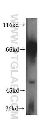 RIOK1 Antibody in Western Blot (WB)
