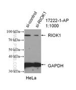 RIOK1 Antibody in Western Blot (WB)