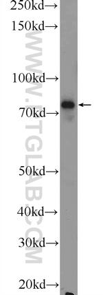 Factor XIIIa Antibody in Western Blot (WB)