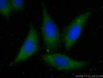 CD5L Antibody in Immunocytochemistry (ICC/IF)