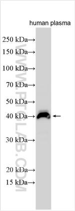 CD5L Antibody in Western Blot (WB)