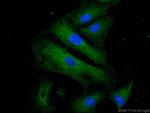 USHBP1 Antibody in Immunocytochemistry (ICC/IF)