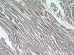 USHBP1 Antibody in Immunohistochemistry (Paraffin) (IHC (P))