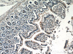 USHBP1 Antibody in Immunohistochemistry (Paraffin) (IHC (P))