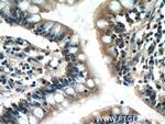 USHBP1 Antibody in Immunohistochemistry (Paraffin) (IHC (P))